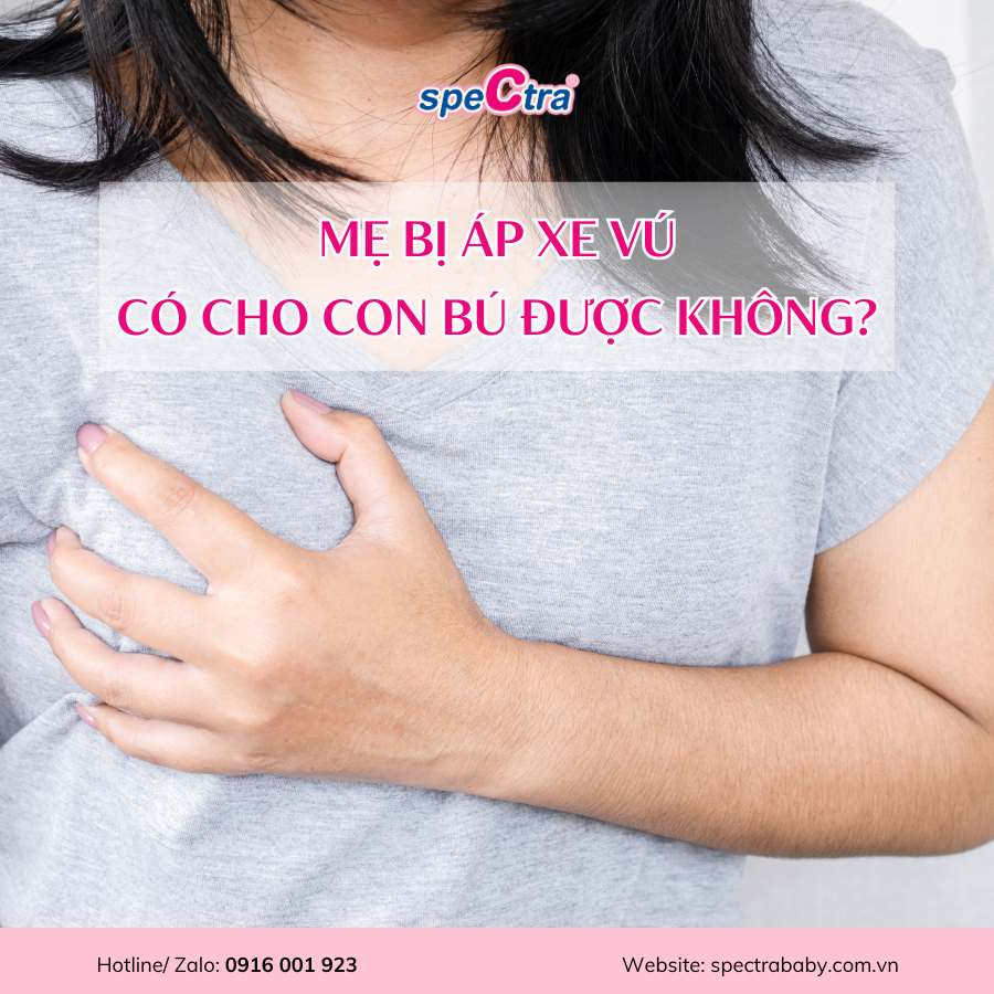 MẸ BỊ ÁP XE VÚ CÓ CHO CON BÚ ĐƯỢC KHÔNG?
